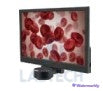 10.1-inch Display Screen Accessories